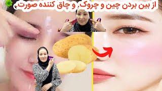 ماسک کچالو چاق کننده صورت و از بین برنده چین و چروک. ️