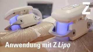 Z Lipo & Z WavePro – Cool zur Traumfigur