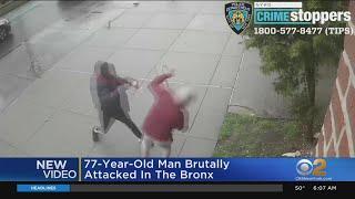 77-year-old man brutally attacked in the Bronx