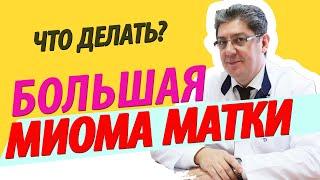 Большая миома матки большой миоматозный узел