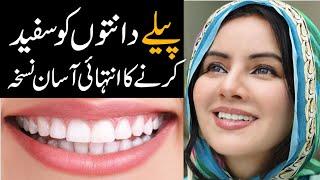 My Secret to go from Yellow to White Teeth  Rabi Pirzada