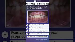 NEET MDS  INI-CET MDS  PSC  BDS - Most Important Questions  #neetmds2025 #mdsprep