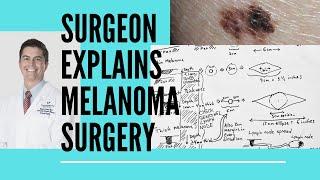 Surgeon explains melanoma surgery