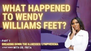 What Happened To Wendy Williams Feet? Breaking Down Lymphedema Part 1