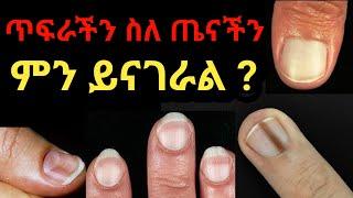 ጥፍራችን ስለ ጤናችን ይናገራል ተመልከቱ  dryonas  ዶር ዮናስ  janomedia  ጃኖ ሚዲያ