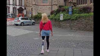 AMPUTEE WALKING along the streets of Germany