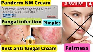 Panderm NM Cream ke fayde panderm nm use in hindi पेंडरम एनएम क्रीम lagane se kya hota hai