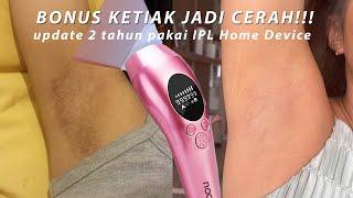 ALAT PENGHILANG BULU TERBAIK?? IPL Hair Removal Home Device With Cooling System  Update Review FAQ