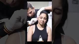 Neck hump treatment #trend #feed #shortvideo