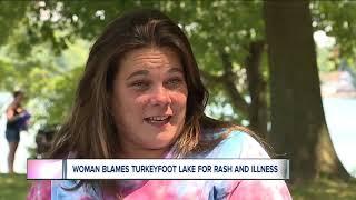 Woman claims she got sick from E. coli in Turkeyfoot Lake