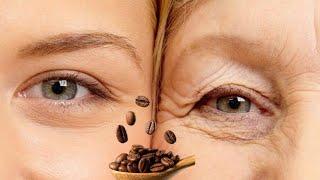 How To Get Rid Of Under Eye Wrinkles  Removing Wrinkles and Dark Circles Around the Eyes