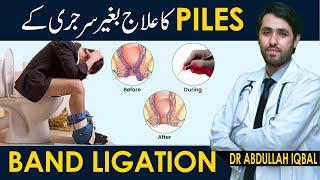 Get Rid Of Piles Without Surgery in 24 hours  Band Ligation   Bawseer Ka Fori Ilaj