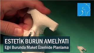 ESTETİK BURUN AMELİYATI - EĞRİ BURUNDA MAKET ÜZERİNDE AMELİYAT PLANLAMASI  PROF. DR. TEOMAN DAL