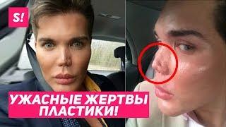 САМЫЕ ЖУТКИЕ ЖЕРТВЫ ПЛАСТИКИ  ЖИВЫЕ КЕНЫ 