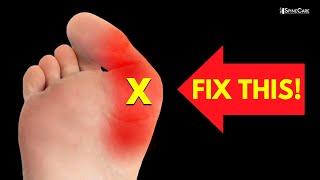 How to Relieve Bunion Pain at Home NO EQUIPMENT