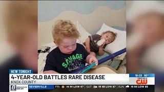 Powell 4-year-old battles rare disease months after it kills his brother