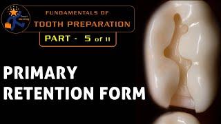 Fundamentals of tooth preparation - Part 5  Dr Benin