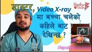 Video Xray मा बच्चा चलेको कहिले बाट देखिन्छ ?   Episode 3 @DrNiteshGhimireNepaleseDoctor