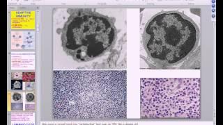 Medical School Pathology 2013 Season Session #9 Immune Disorders I