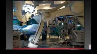 Webinar Magellan and Why We Need Intravascular Robotics