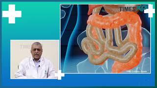 Treating Colon & Rectum Cancer with Dr. Paresh Varty  Lilavati Hospital Mumbai  Times XP