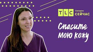 Современная дерматология  Спасите мою кожу  TLC