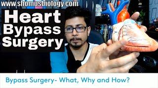 Bypass surgery Hindi Coronary artery bypass surgery