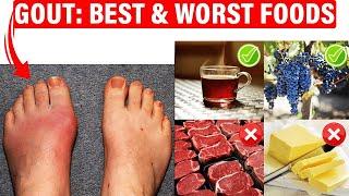 Best Gout Diet & Foods To Avoid URIC ACID Foods that Cause Gout