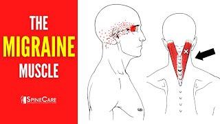 How to Release Tension for FAST MIGRAINE RELIEF