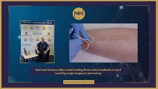 Think Your Varicose Veins Are Untreatable? Think Again By Prof  Mark Whiteley