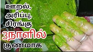 Simple home remedies for skin allergy itching itching