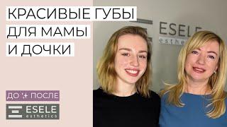 ЧТО НУЖНО ЗНАТЬ ПЕРЕД ТЕМ КАК ДЕЛАТЬ КОНТУРНУЮ ПЛАСТИКУ ГУБ?