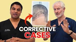 How We Manage And Assess Corrective Case  The Hair Loss Show