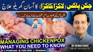 Chickenpox How to avoid it how to treat it and what to do if you get it #chicken pox #treatment