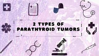 2 Types Of Parathyroid Tumors