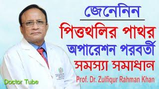 পিত্তথলির পাথর অপারেশন পরবর্তী সমস্যা সমাধান  Gallbladder Stone infection  Bangla Health Tips