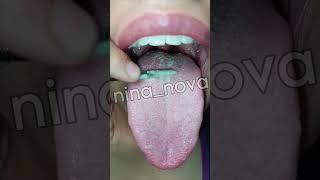 White tongue scraping Morning dirty tongue brushing cleaning