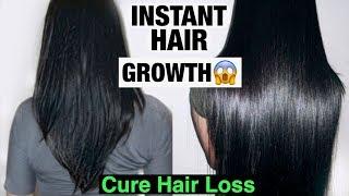 DIY HAIR GROWTH  HOW TO GROW LONGER THICKER HAIR 100% WORKS + STOP HAIR LOSS  Naturally & Fast