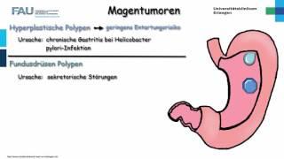 Pathologie ─ Magentumoren