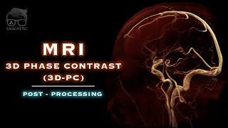 MRI 3D PHASE CONTRAST 3D-PC – POST-PROCESSING