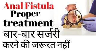 Fistula ka best treatment kya hai