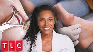 Dr. Ebonie Removes Massive Bunion and Fixes Foot Deformity  My Feet Are Killing Me