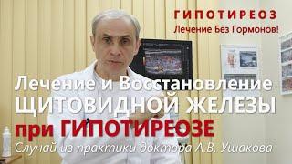 Гипотиреоз Лечение без гормонов Щитовидной железы. Пример случая из практики  Доктор Ушаков