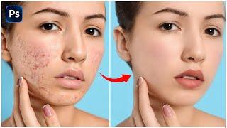 Skin Retouching 2024  High-End Face Retouching - Best Photoshop Tutorial
