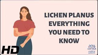 Unlocking the Mystery of Lichen Planus  Everything You Need to Know