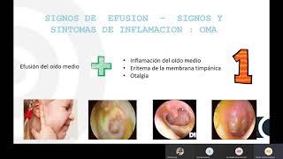 Otitis sinusitis faringitis rinofaringitis. Dr Briceño.