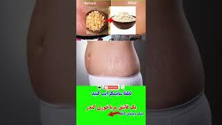 درمان ترک های پوستی چگونه ترک های پوستی را از بین ببریم #shorts #سلامتی_با_ماساژ #پوست #بارداری