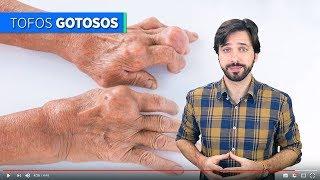 O QUE É A DOENÇA GOTA?