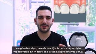 Denizhan Uzunpınar  Porselen Laminalar