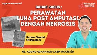 PERAWATANLUKA POST AMPUTASI DENGAN NEKROSIS  Layanan Konsultasi